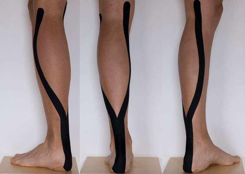 how does kinesio taping work