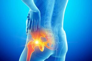 Addressing-Hip-Pain