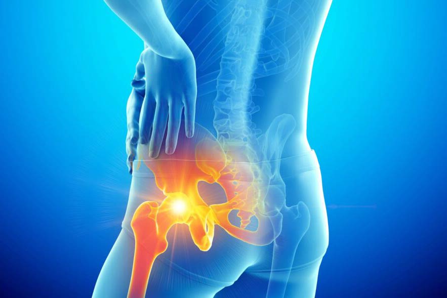 Addressing-Hip-Pain