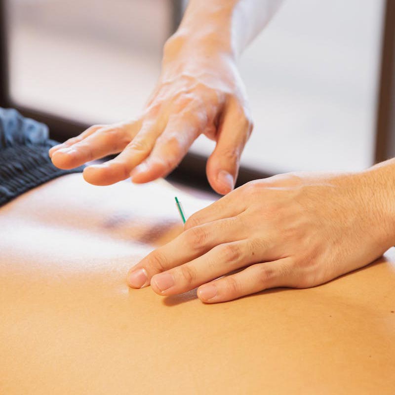 acupuncture-clinic-calgary